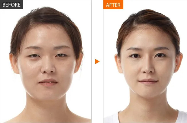 Cách massage mặt kiểu Nhật Asahi đem lại hiệu quả trong vài tuần đến vài tháng