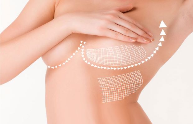 Ngực chảy xệ sẽ không còn là vấn đề khi massage